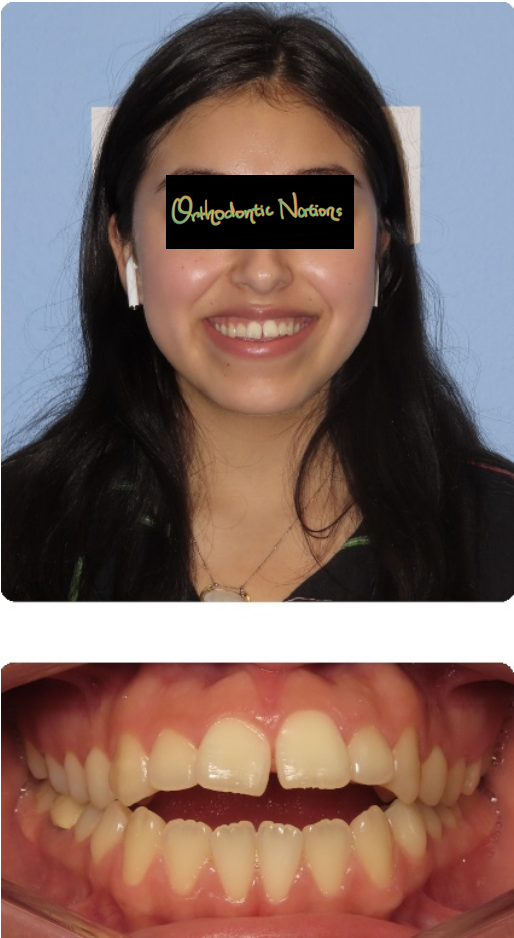 Dr. Kaifeng Yin Orthodontic Nations Orthodontist in The Woodlands, Conroe and Spring TX 77384